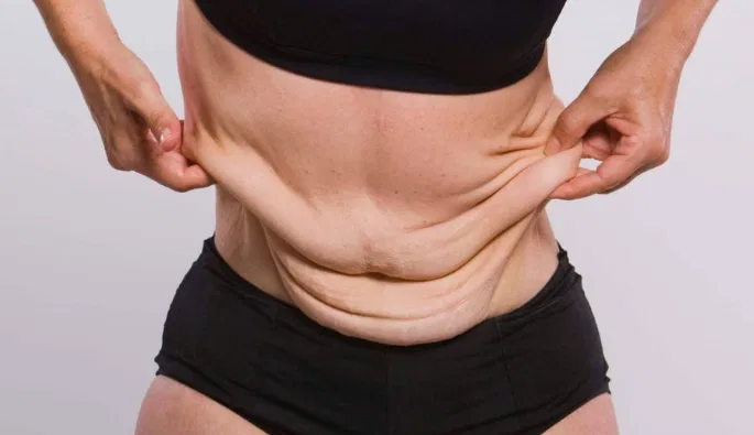 Peau flasque ventre